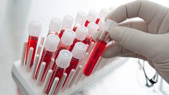 تحليل جديد للدم يكشف السرطان في مراحله المبكرة