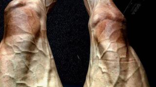 مشهد لا يصدق لما تبدو عليه ساقا دراج خلال سباق فرنسا