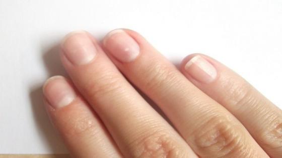 طبيب نرويجي: أطوال أصابع اليد تدل على ميول الإنسان
