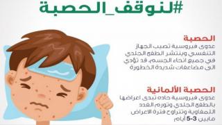 حملة التطعيم ضد مرض الحصبة للأطفال تنطلق غداً في مراكز الرعاية الأولية التابعة لوزارة الصحة، ووكالة الغوث (أونروا)