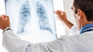 مفاجأة.. الرئة تقوم بوظيفة أخرى بجانب التنفس